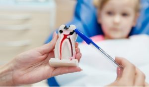 Cách khắc phục răng trẻ bị đen